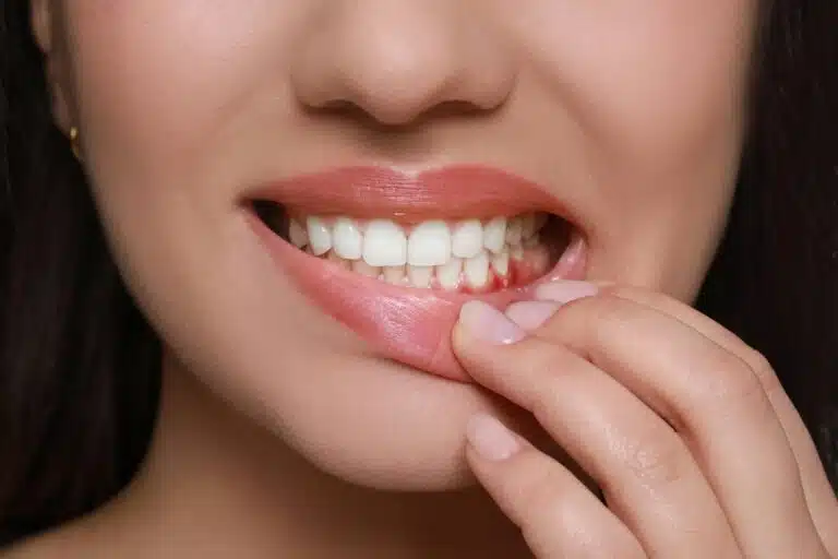 Signs Your Dental Implant May Be Failing