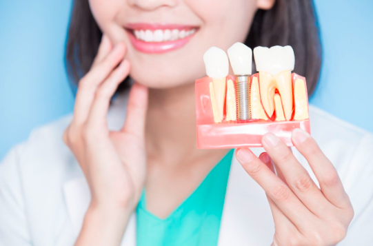 What Affects the Lifespan of Dental Implants