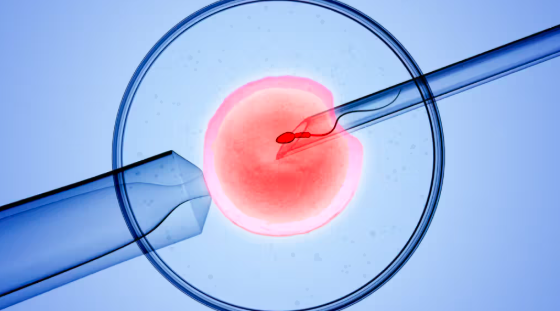 Does Impact Health Cover IVF?