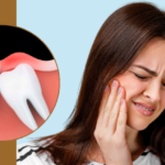 What Is Wisdom Tooth Pain? 