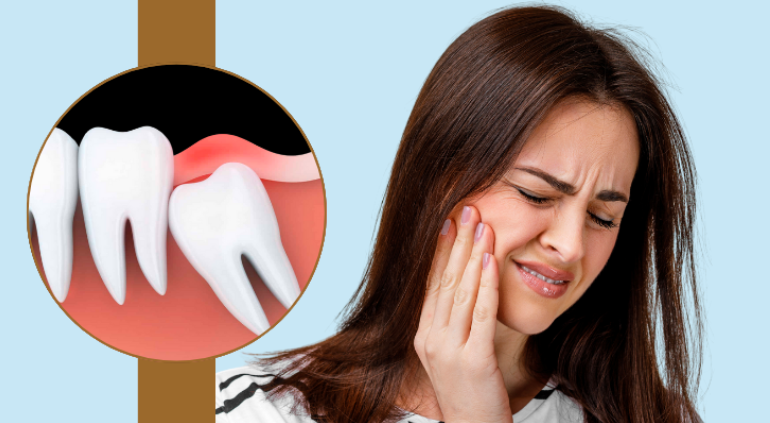 What Is Wisdom Tooth Pain? 