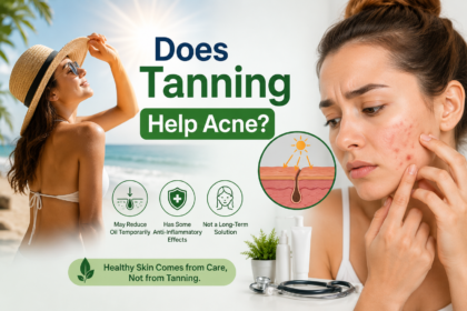 Does Tanning Help Acne What