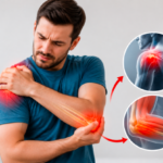 Does Tennis Elbow Cause Shoulder Pain?