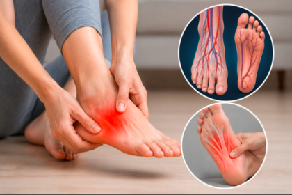 Insufficient Circulation in Feet Pain in Arch