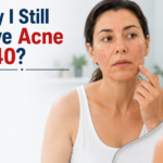 Why I Still Have Acne at 40