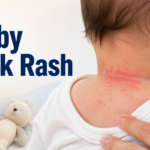 Baby Neck Rash