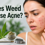 Does Weed Cause Acne?