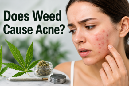 Does Weed Cause Acne?