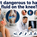 Is it dangerous to have fluid on the knee?