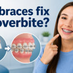 can braces fix an overbite​?