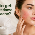 how to get rid of redness from acne?