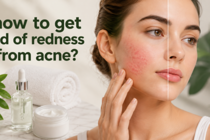 how to get rid of redness from acne?